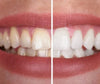 Whitening Teeth Paint