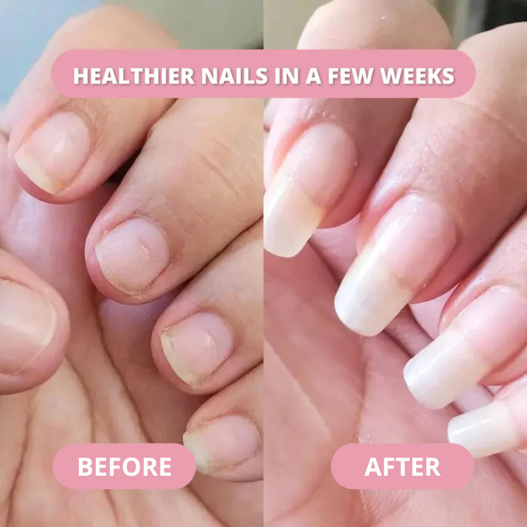 Nail Growth Pen