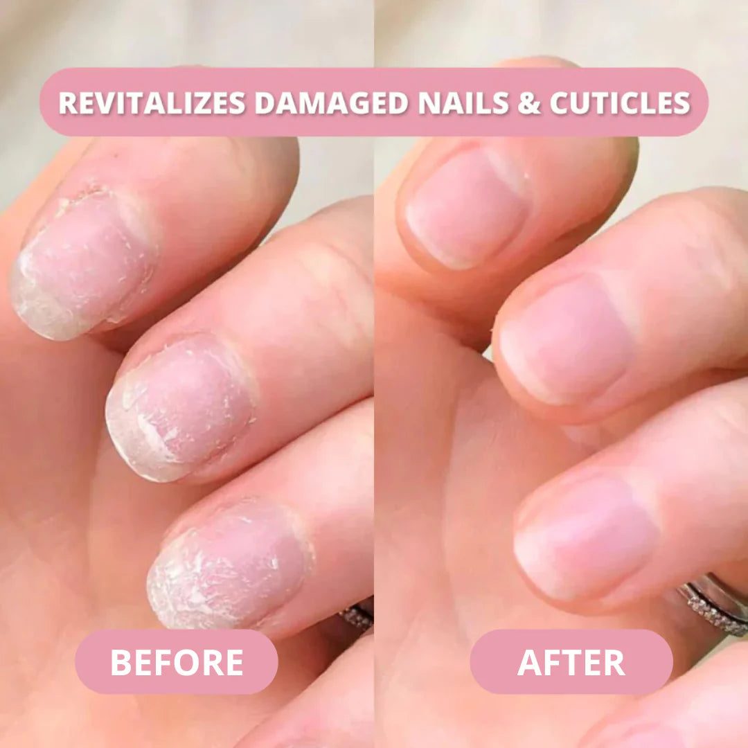 Nail Growth Pen