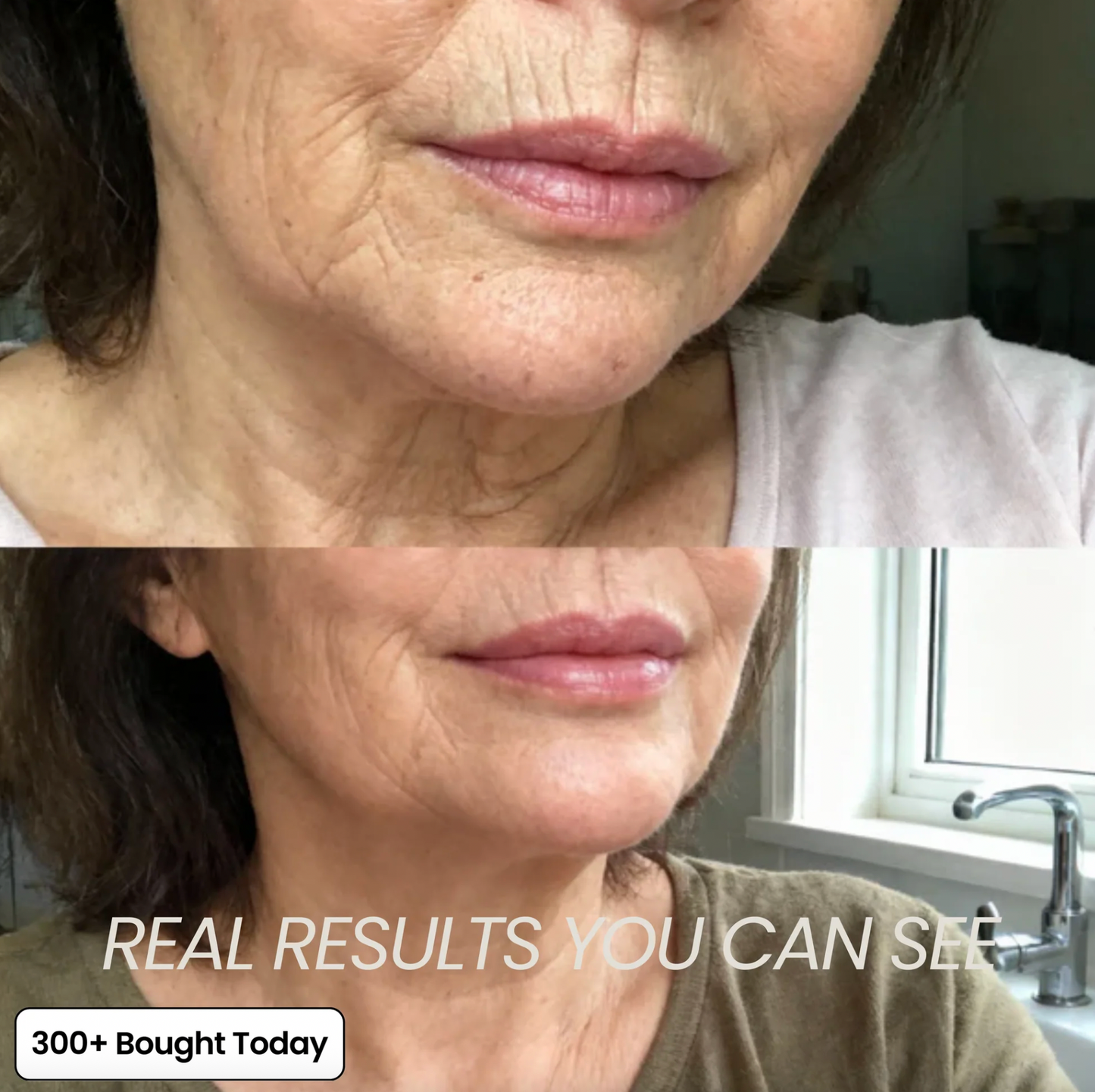 Transform Wrinkles, Fine Lines, And Tired Creases Naturally